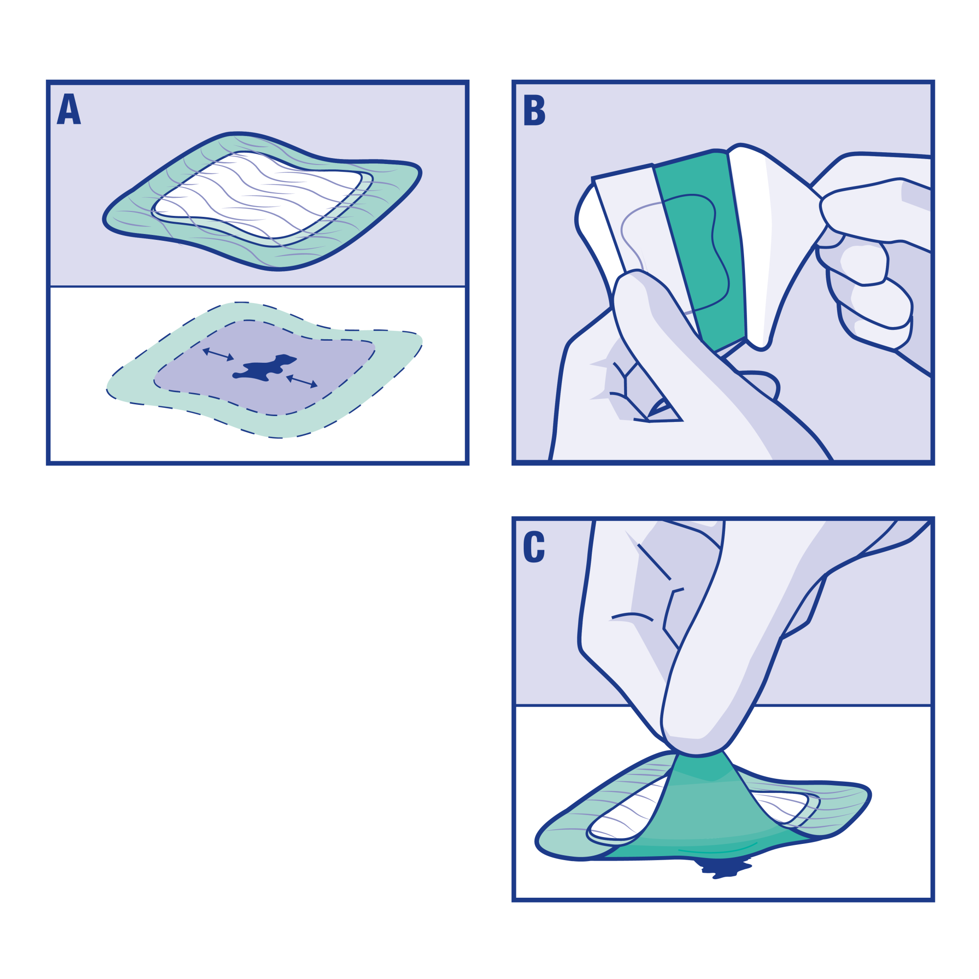 Immagine della procedura di applicazione di Cutimed® Siltec® Sorbact® Sacrum Immagine della procedura di applicazione di Cutimed® Siltec® Sorbact® Sacrum